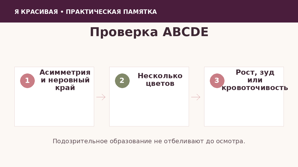 Признаки подозрительного пигментного образования ABCDE